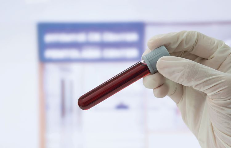 Bloodborne Pathogen Safety: Occupational Health & OSHA Compliance Resources