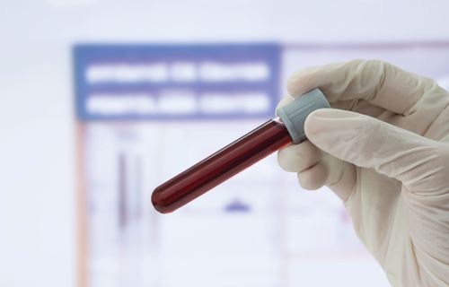 Bloodborne Pathogen Safety: Occupational Health & OSHA Compliance Resources
