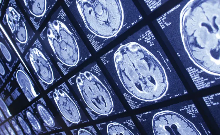 A Concussion Can Leave a Lasting Impact: Coach Your Community on How to Recognize and Prevent Traumatic Brain Injury (TBI)